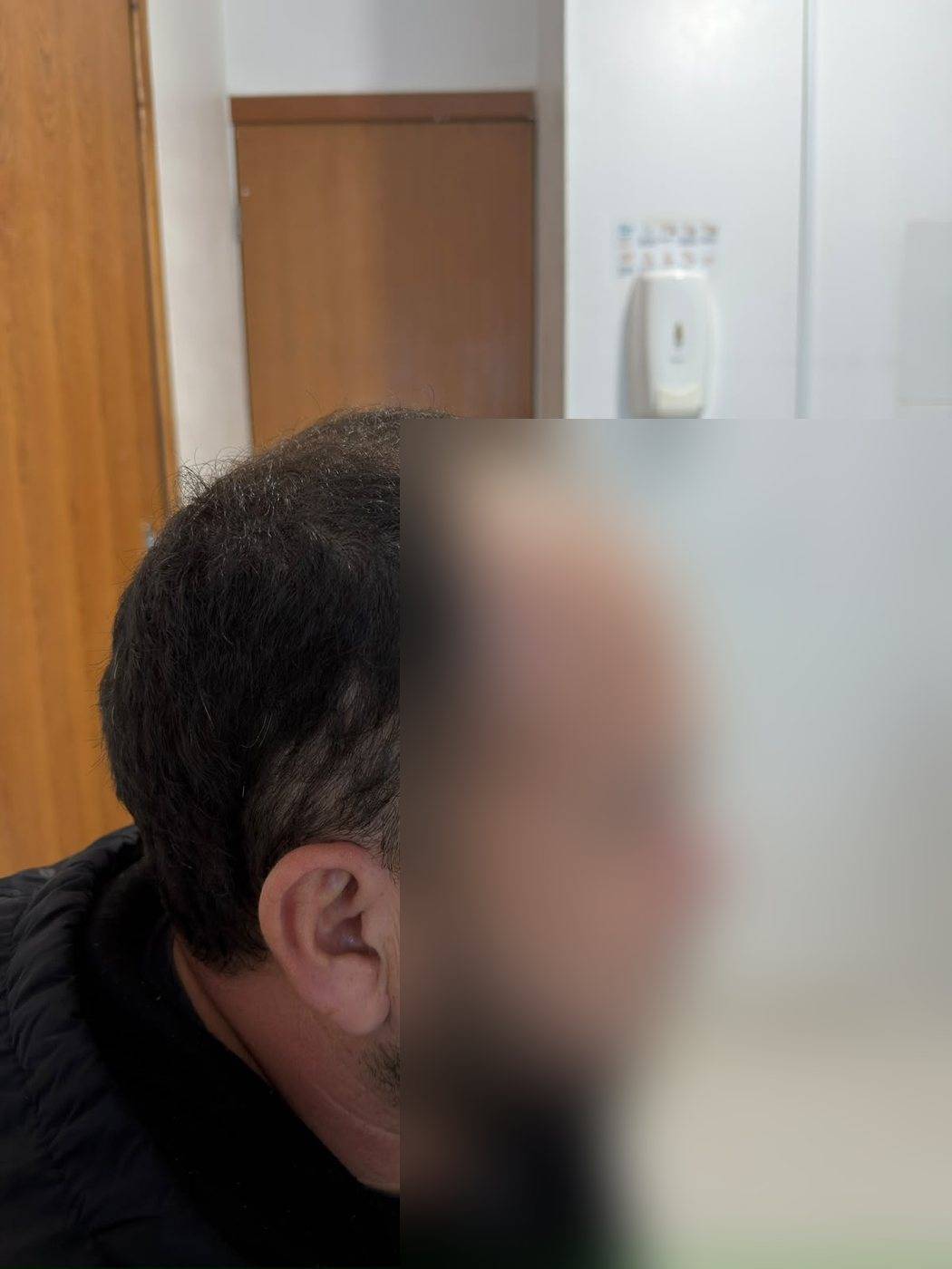 Antes: entradas e linha frontal recuada